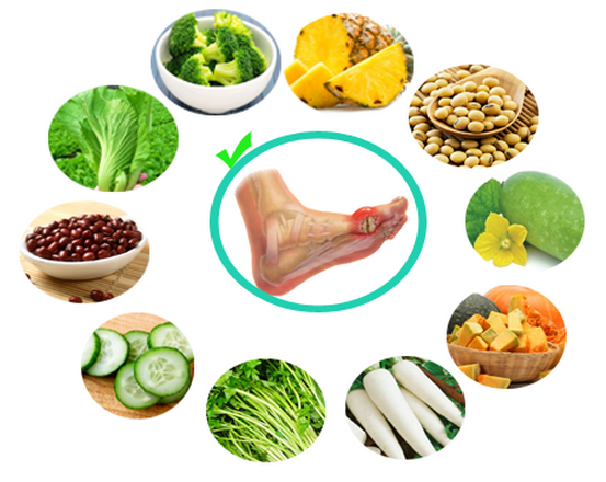 8 cách giảm acid uric không dùng thuốc