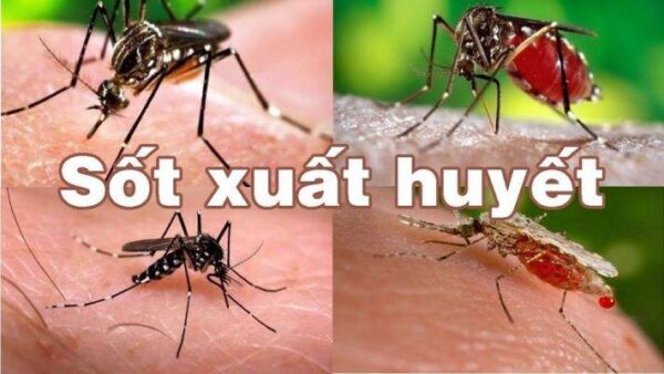 Chuyên gia cảnh báo 3 sai lầm khiến bệnh sốt xuất huyết tiến triển nguy hiểm